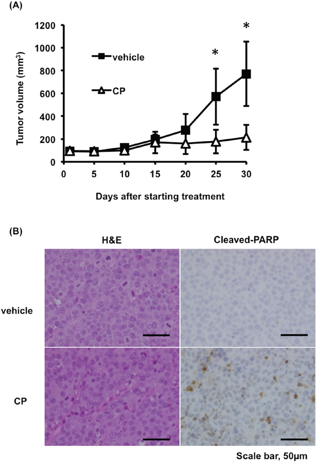 CP inhibits tumor growth in a mouse xenograft model of MM.