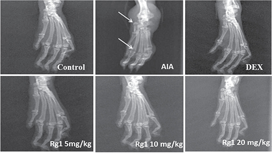 Effects of Rg1 on radiography of the joints of AIA rats.