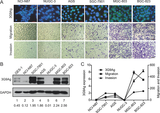 The expression of 3G9Ag is related to migration and invasion ability in GC cells.