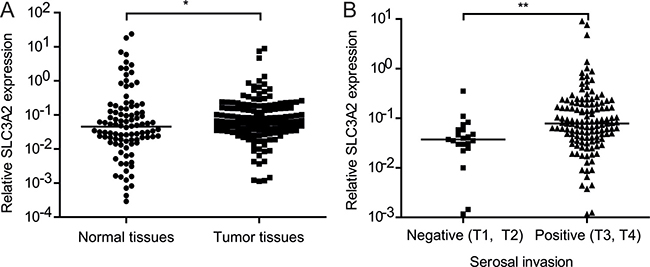 Relationship between SLC3A2 expression and clinicopathological features.