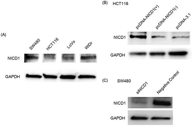 (A) Wetern blot analysis of NICD1 expression in 4 colon cancer cell lines.