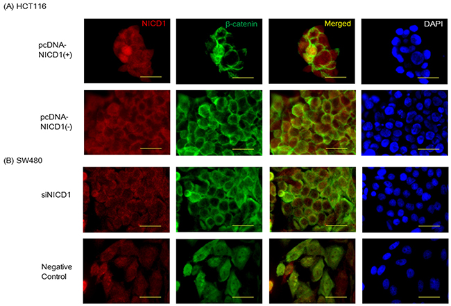 (A) Confocal imaging of NICD1 and &#x03B2;-catenin immunohistochemistry staining in HCT116 cells transfected with pcDNA3.