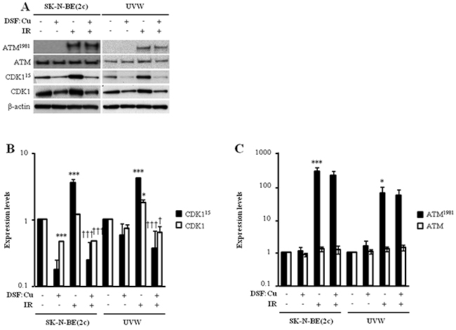 The effect of DSF:Cu on the phosphorylation of ATM and CDK1 induced by ionising radiation.