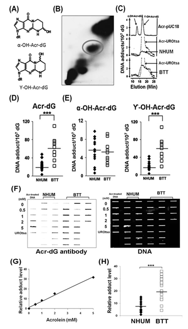 Acrolein (Acr)-dG DNA adduct analysis in normal human urothelial mucosa (NHUM) and bladder tumor tissue (BTT) samples.