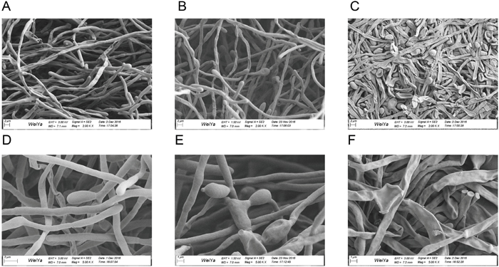 Scanning electron microscopy images of C. albicans biofilms.