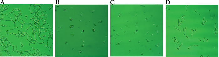 Morphological changes of C. albicans after suloctidil treatment.