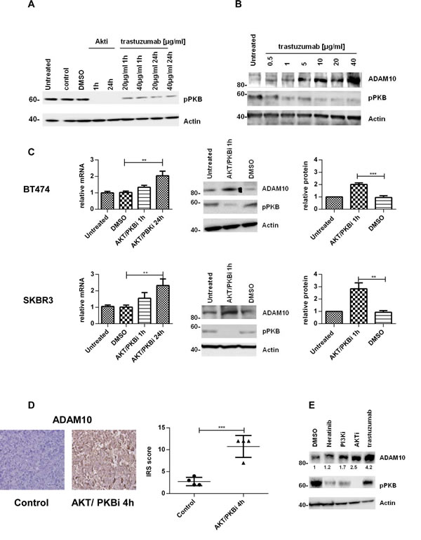The upregulation of ADAM10 is correlated with AKT inhibition in vitro and in vivo (A) SKBR3 cells were treated with an allosteric AKT/PKB inhibitor (2.5&micro;M) or trastuzumab for the indicated durations and (B) with increasing doses of trastuzumab for 24h before western blotting.