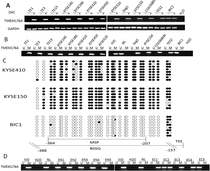 The expression and methylation status of TMEM176A in esophageal cancer.