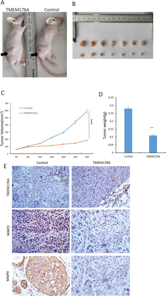 TMEM176A inhibits tumor growth in esophageal cancer cell xenograft mice.