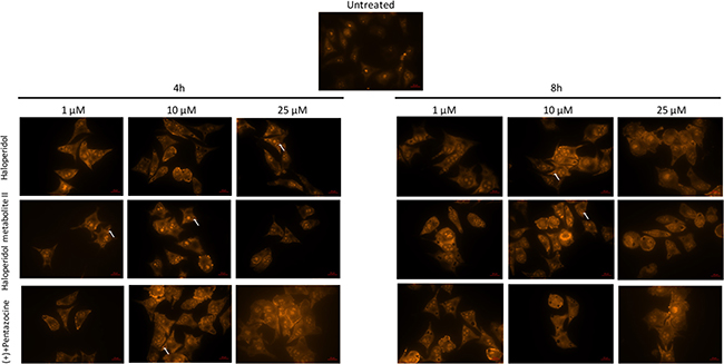 Microscopy analysis of cell autophagy following various pharmacological treatments and time points.