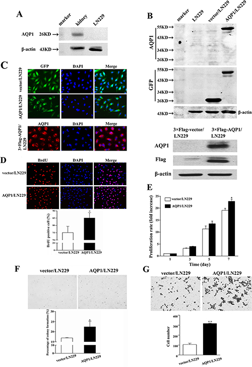Overexpression of AQP1 promoted proliferation and invasion abilities of LN229 cells.
