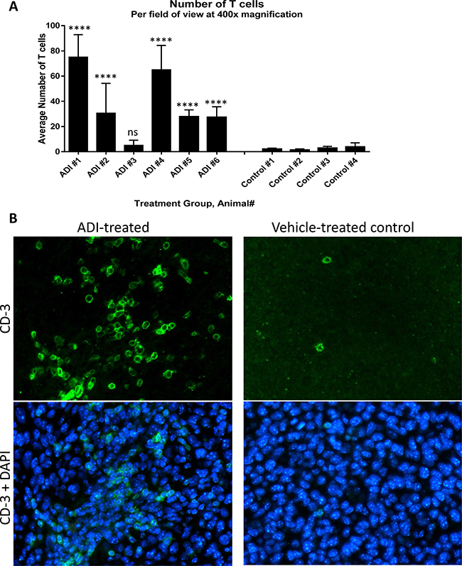 ADI-PEG 20 induces T cell infiltration into B16-F10 tumors.