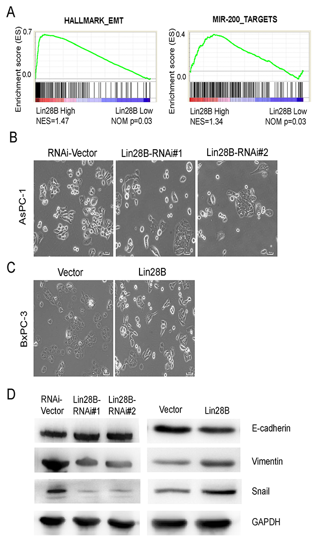 Lin28B silencing inhibits the EMT.