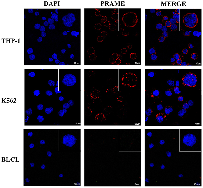 PRAME staining of cellular membrane using confocal microscopy.