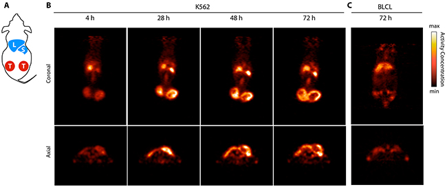 ImmunoPET imaging of PRAME positive tumors using 89Zr-DFO-MPA1.