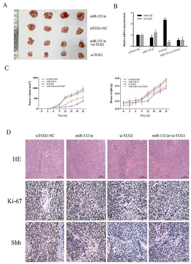 The effect of TUG1 on tumor growth in vivo.