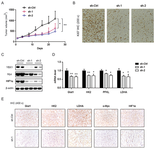 Genetic silencing of YBX1 inhibits tumor growth in vivo.