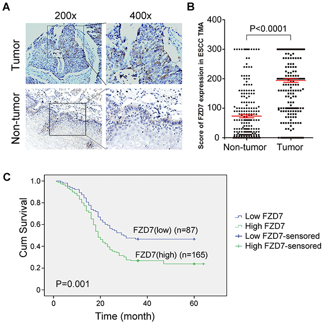 Upregulation of FZD7 in ESCC clinical samples and its prognostic significance in ESCC patients.