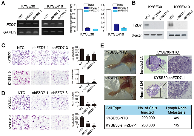 Repression of FZD7 inhibited tumor metastasis in vitro and in vivo.