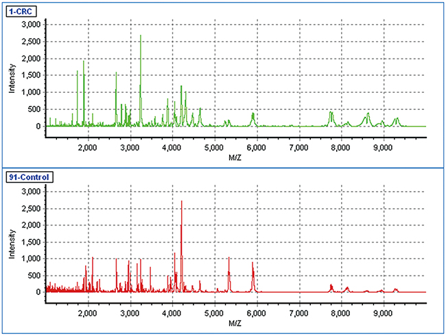 The MALDI-TOF spectra of the serum samples from a CRC patient and a healthy control.