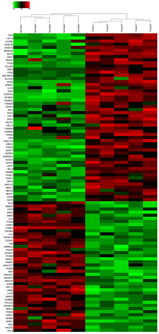 A cluster diagram of RNA-sequencing data from five pairs of small cell lung cancer (SCLC) tissues samples.