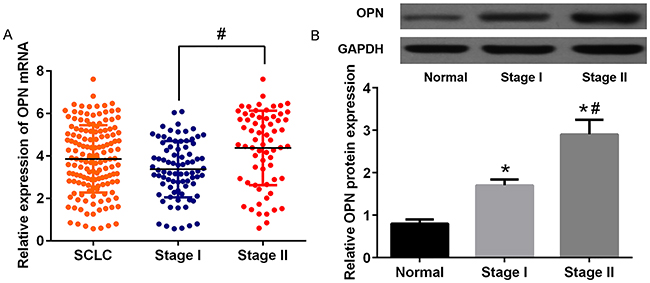 The expression of OPN in different stages of SCLC patients.