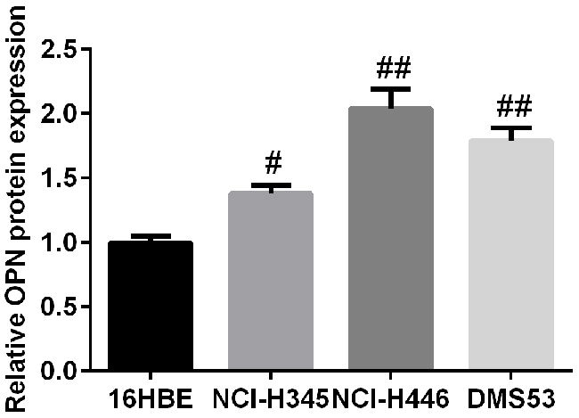 The expression profile of OPN in three SCLC cell lines and human normal bronchial epithelial cell line 16HBE.
