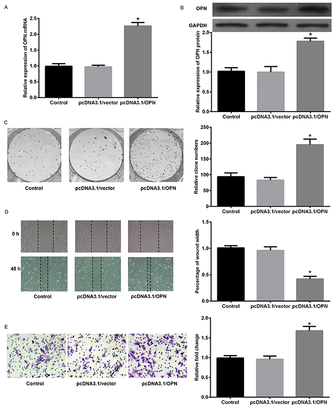 Forced expression of OPN promoted cell proliferation, migration, and invasion ability in SCLC.