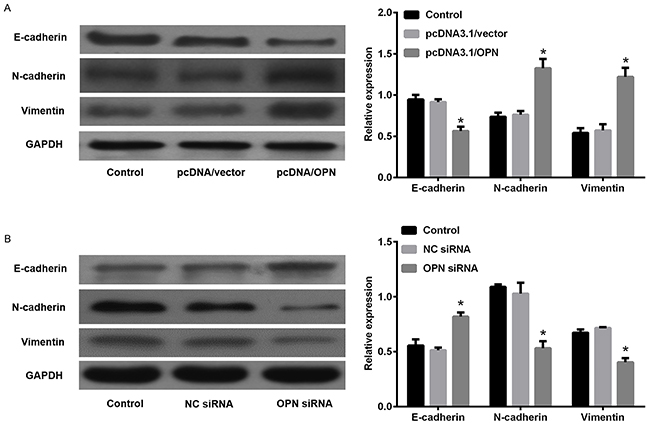 Effects of osteopontin (OPN) on the expression of epithelial-to-mesenchymal transition (EMT) in small cell lung cancer cells.