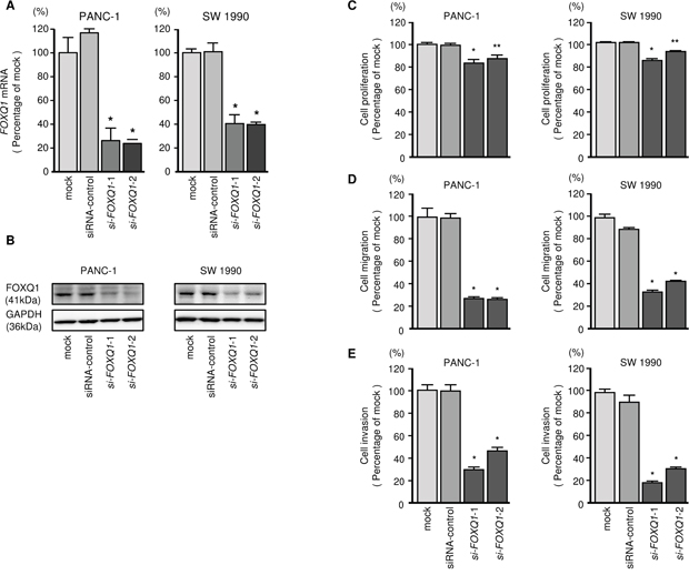 Effects of FOXQ1 silencing on PDAC cell lines.