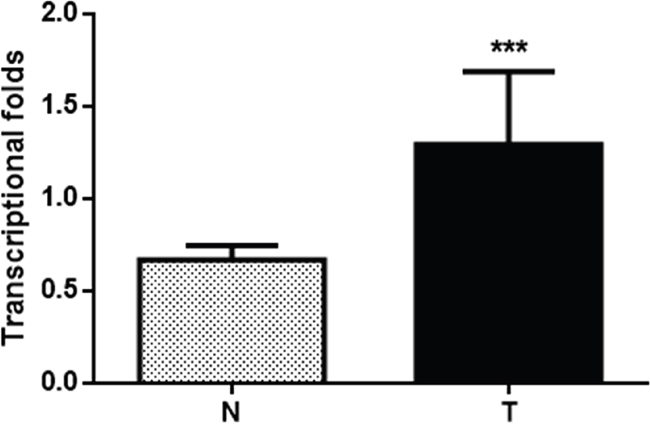 Histogram of HPIP mRNA expression in normal cervical tissues and cervical cancer tissues (N, normal cervical tissues; T, cervical cancer tissues).