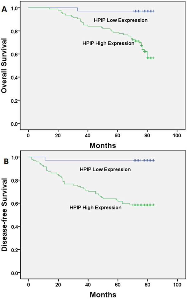 Kaplan-Meier analysis of overall survival and disease-free survival related to the expression of HPIP.