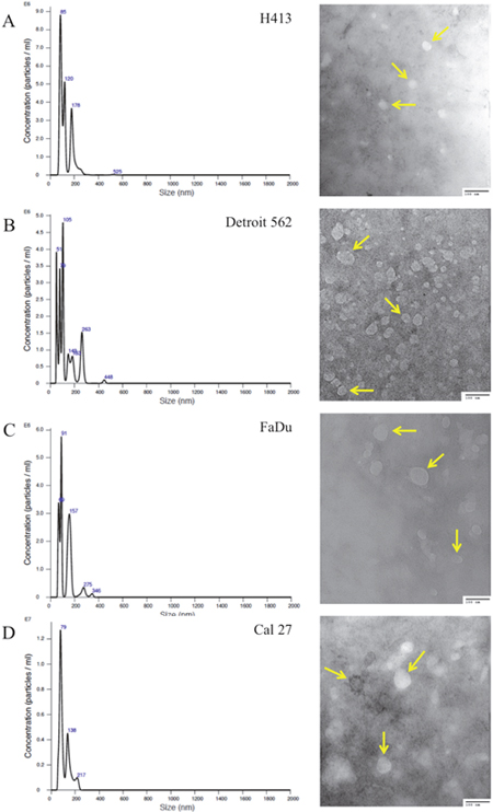 Size distribution plots from nanoparticle tracking analysis of exosome isolates from culture media of head and neck squamous cell carcinoma (HNSCC) cell lines.