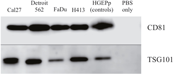Western blot analysis of protein expression of exosome-associated tetraspanin CD81 and cytosolic endosomal sorting complex component TSG101 for exosome isolates from conditioned cell culture media for head and neck squamous carcinoma cell lines and primary non-pathologic oral epithelial cells.