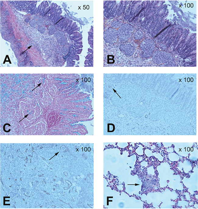 Pathological analysis of caecum and lungs in the tumour mouse model.