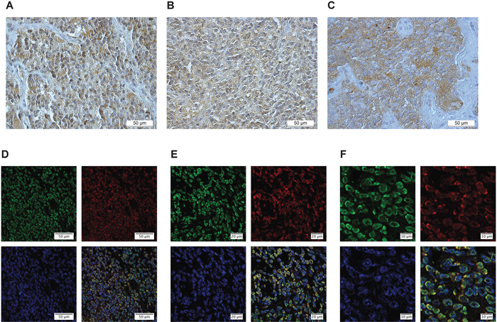 CMKLR1, GPR1 and chemerin are expressed in neuroblastoma primary tumors.