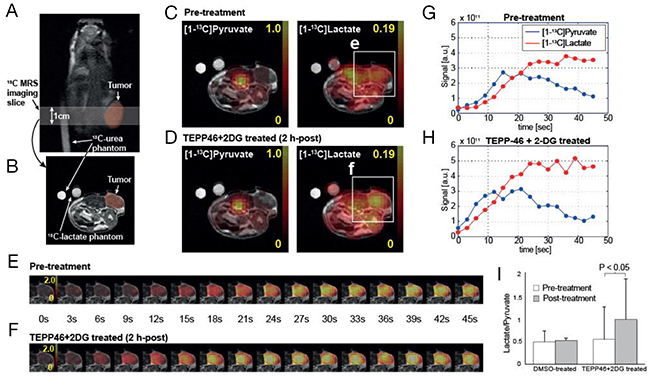 Acute metabolic responses of TEPP-46 and 2-DG combination treatment in subcutaneous tumor measured by hyperpolarized 13C MR spectroscopic imaging.