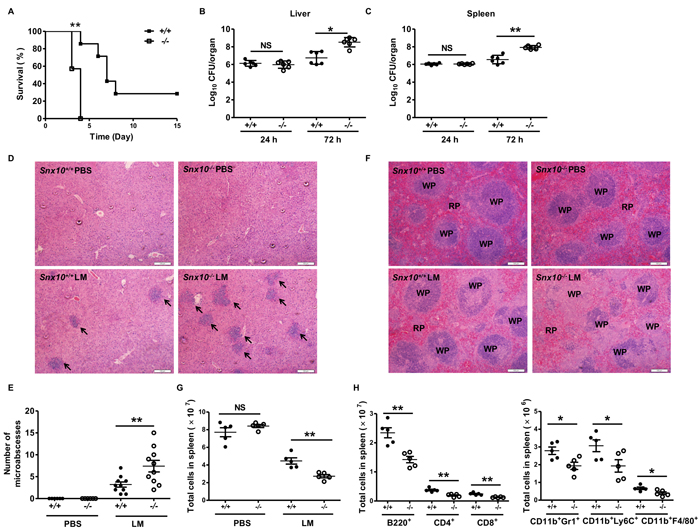 SNX10-deficient mice are more susceptible to bacterial sepsis.