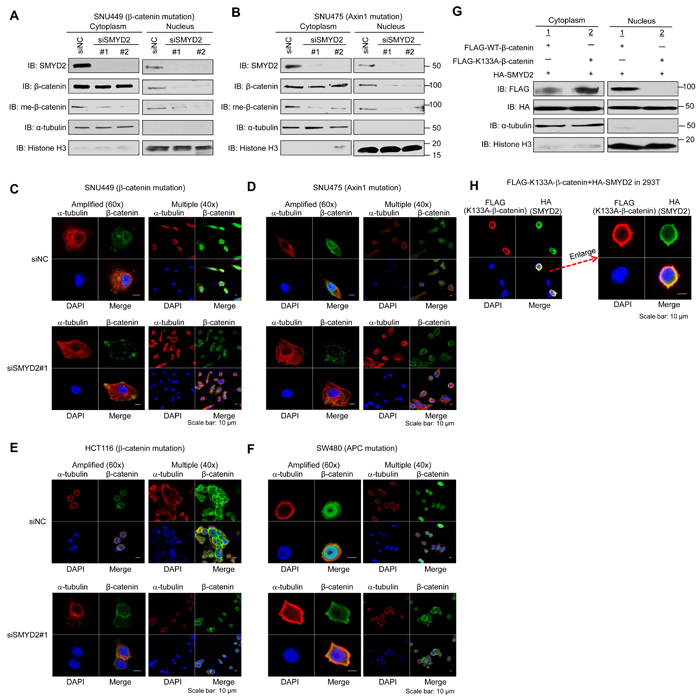 SMYD2-mediated methylation of &#x3b2;-catenin plays a critical role on nuclear translocation of &#x3b2;-catenin.