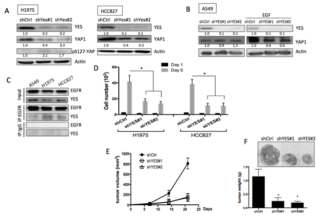 Role of YES in EGFR-mediated YAP1 expression and function.