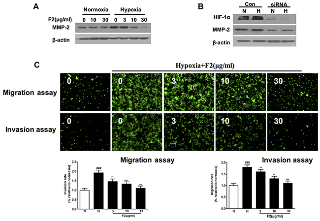 The effects of F2 on expression of MMP-2 and migration and invasion of U87 cells.