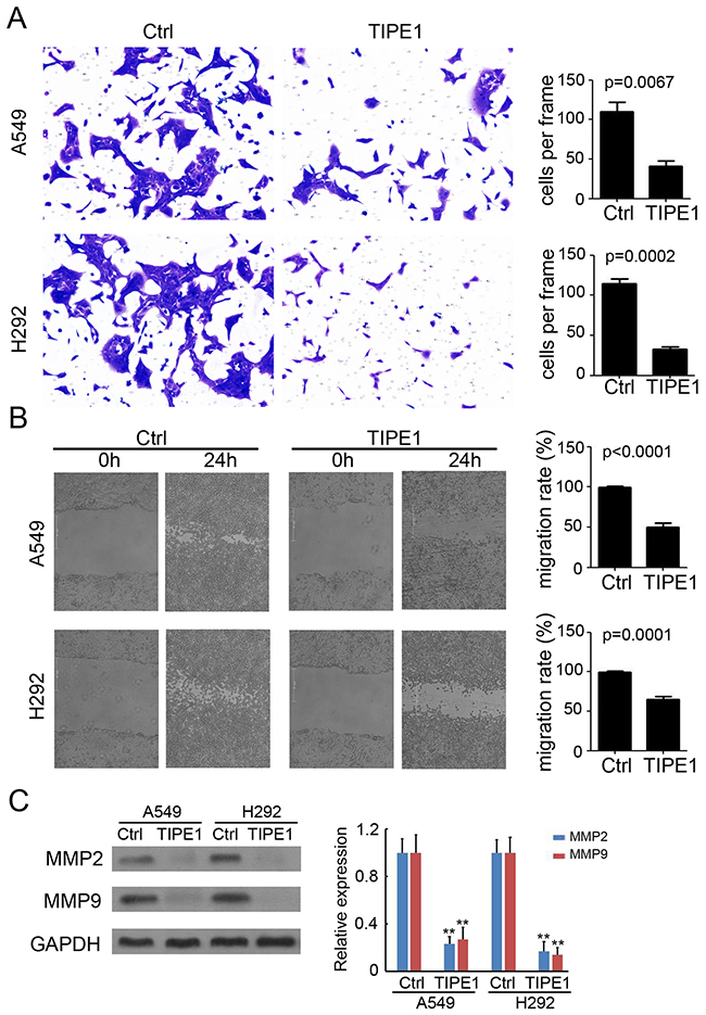TIPE1 inhibits invasion and migration in lung cancer cells.