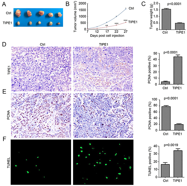 TIPE1 inhibited tumorigenesis in vivo.