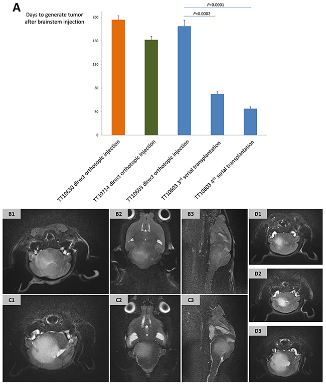 The establishment of DIPG xenograft models and their MRI manifestations.