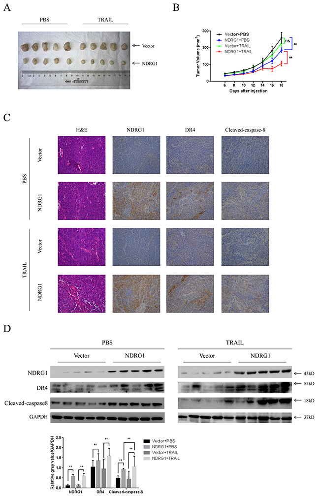 NDRG1 increased sensitivity of CRC cells to TRAIL in vivo.