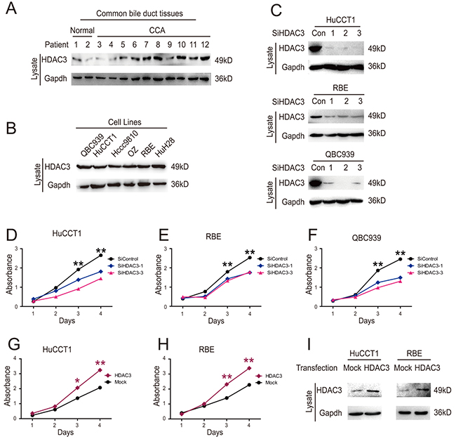 HDAC3 promotes growth of CCA cells.