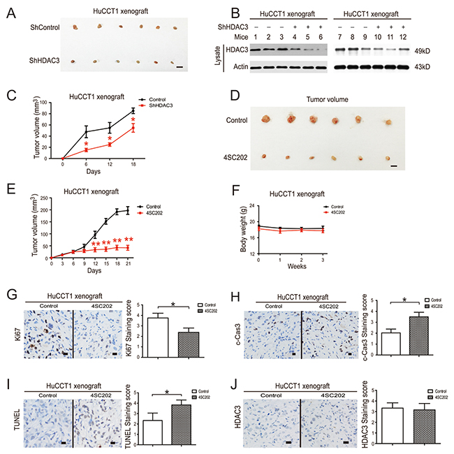 HDAC3 inhibition reduces growth of CCA tumor xenografts.