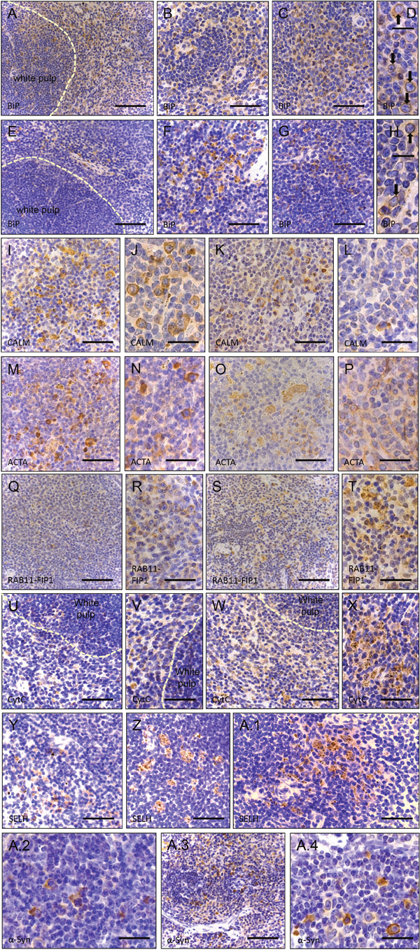 Immunohistochemistry of paraffin sections of paraformaldehyde-fixed spleen specimens of 26-week old control (wt) and of Sil1 mutant mice.