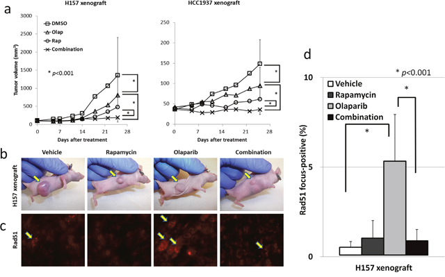 The combination of rapamycin and olaparib inhibits NSCLC and TNBC tumor growth in vivo.