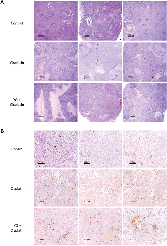 Oxygen carrier YQ23 combined with Cisplatin treatment induced more necrosis and apoptosis in tumor tissues.